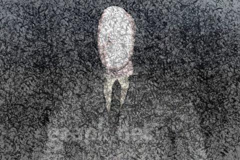 Real slender man